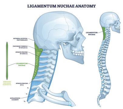 Ligamentum nuchae anatomy in a clean neck outline, highlighting the green ligament from occiput to C7 with skull and cervical spine labeled for learning. Outline diagram