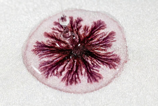 Bloodstain forensic analysis fabric evidence laboratory criminology investigation textile sample crime scene science