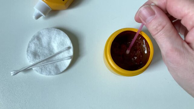 A woman holds a cotton swab soaked in iodine, preparing to treat the wound. A woman's hand with an iodized cotton. Caring and willingness to quickly provide first aid in a domestic situation