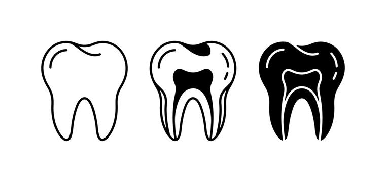 Dental Health Progression Icons: Healthy Tooth, Cavity Formation, and Tooth Decay Stages, Vector Illustration for Oral Care Concepts