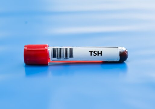Blood sample tube for TSH test analysis.