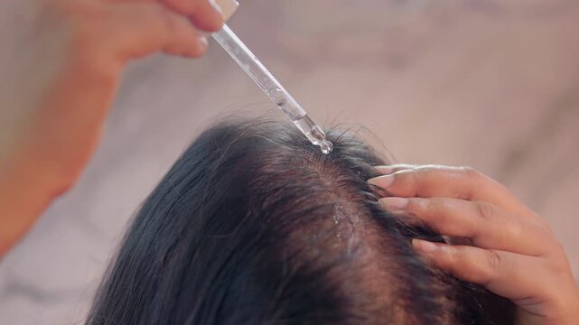 Woman applying serum on scalp with a dropper on visible bald spot and massaging with fingers in indoor setting, hair loss treatment and hair care concept.