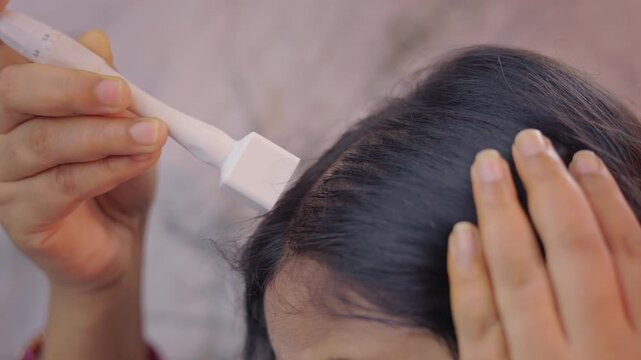 Close up shot of a woman using derma stamp on her scalp to stimulate hair roots, microneedling treatment for hair loss.