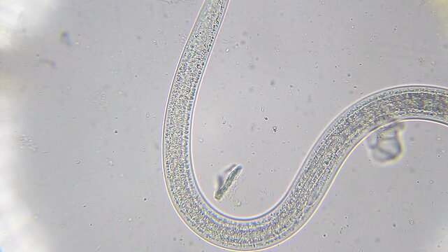 Nematode moving slowly in water droplet under 400x magnification brightfield microscopy. 4K scientific microscopy footage.