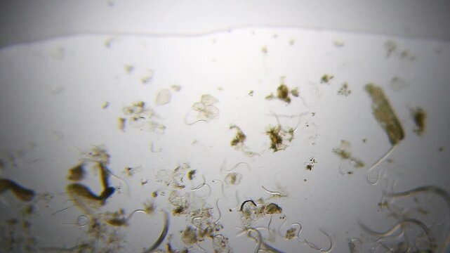 Nematodes aggregation actively moving in water droplet under 40x magnification brightfield microscopy. 4K scientific microscopy footage.