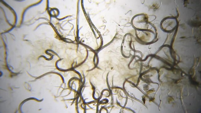 Nematodes aggregation actively moving panoramic view under 40x magnification brightfield microscopy. 4K scientific microscopy footage.