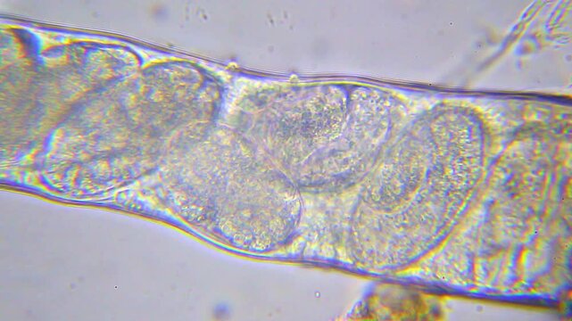 Eggs visible inside moving nematode under 400x magnification brightfield microscopy. 4K scientific microscopy footage.