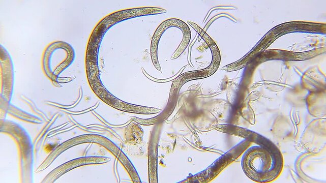 Nematodes aggregation moving slowly panoramic view under 100x magnification brightfield microscopy. 4K scientific microscopy footage.
