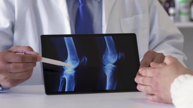Doctor and tablet for x ray with knee, scan or osteoporosis with point at hospital. People, application and ux for medical consultation for arthritis, feedback or report for wellness at clinic office