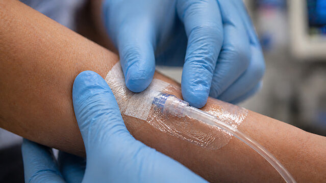 Close Up of Gloved Hands Applying Transparent Medical Dressing Over IV Line for Intravenous Therapy Procedure