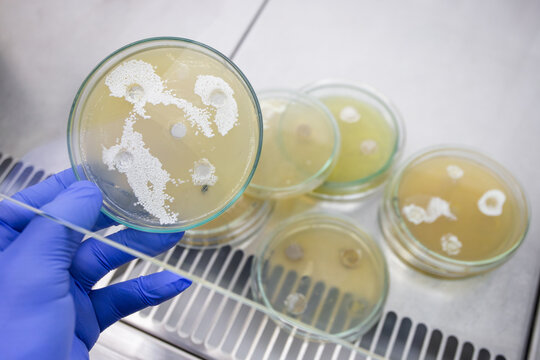 White colonies of actinobacteria in a petri dish against the background of stacks of petri dishes in a laminar flow microbiological cabinet.