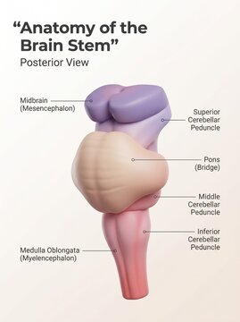 The brain stem with blocked blood flow diagram shows anatomy