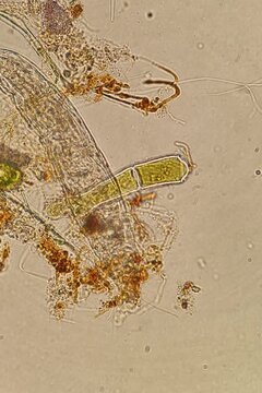 Bdelloid rotifer at 20x under brightfield microscopy