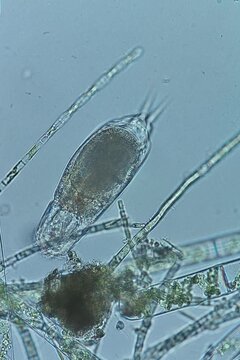 
Bdelloid rotifer at 20x under brightfield microscopy