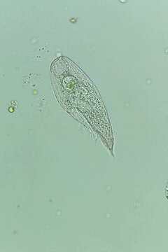 Blepharisma ciliateat 20x under brightfield microscopy
