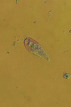 Blepharisma ciliate at 10x under polarized light microscopy