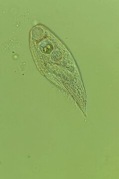 Blepharisma ciliate at 50x under polarized light microscopy