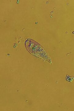 Blepharisma ciliate at 20x under polarized light microscopy