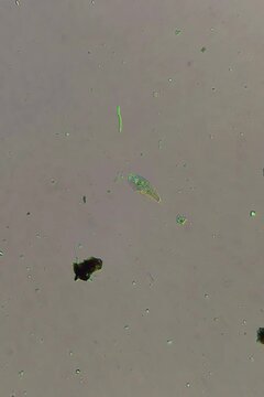 Blepharisma ciliate under polarized light microscopy