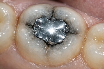 Fototapeta premium A close-up shot of a tooth with a toothbrush inside, great for dental or oral health-related uses