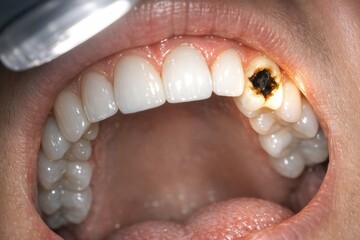 Obraz premium A close-up view of someone brushing their teeth, highlighting the details of oral hygiene