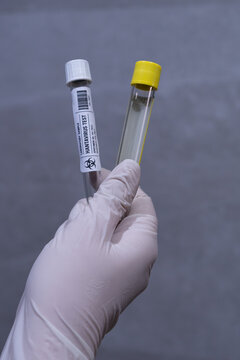 Close-up of a hand wearing protective gloves holding two laboratory sample tubes labeled for hantavirus testing in a scientific research environment.
