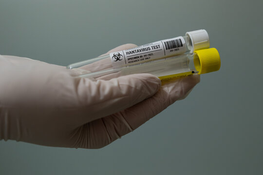 Gloved hand holding two hantavirus laboratory sample tubes