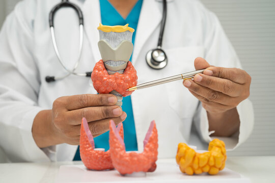 Hyperthyroidism, Overactive Thyroid, Thyroid Lymphoma, Asian doctor with thyroid gland human anatomy model in hospital.