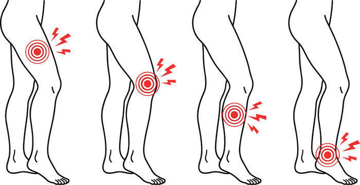 Set of Body Pain Icons Depicting Leg and Knee Pain with Red Circles and Lightning Symbols for Medical and Health Illustrations