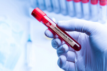 Naklejka premium Laboratory worker holding hantavirus blood sample during infectious disease testing
