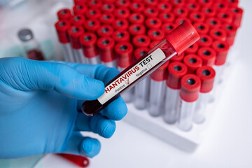 Fototapeta premium Hantavirus blood test tube in laboratory research and medical analysis setting