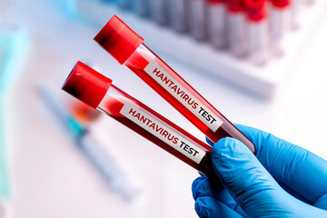 Fototapeta na wymiar Hantavirus testing concept with blood tubes and protective medical gloves
