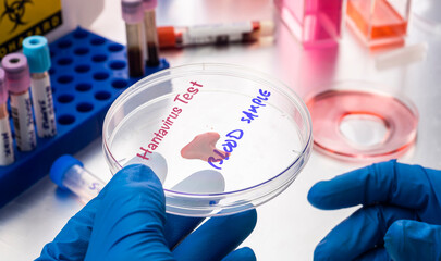 Naklejka premium Scientist holding blood sample on a petri dish in a laboratory, study of Hantavirus infection in humans, conceptual image