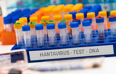 Fototapeta premium Several hantavirus positive research vials in a laboratory, conceptual image