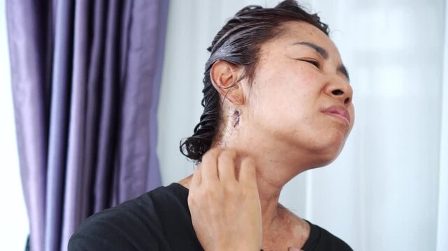 Asian woman scratching her face and neck due to intense itchiness from a hair dye allergy. Concept of skin irritation, scalp dermatitis, and chemical sensitivity after hair coloring