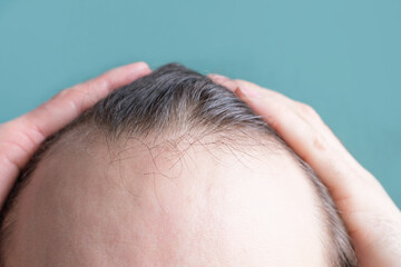Fototapeta premium Man touching her hair close-up on mint background, hair loss concept.