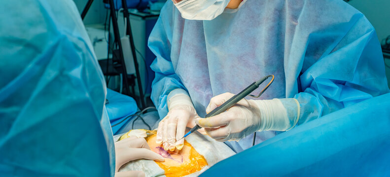 Close-up of a surgeon hands in sterile gloves performing a precise skin incision using an electric cautery tool during surgery in a hospital.