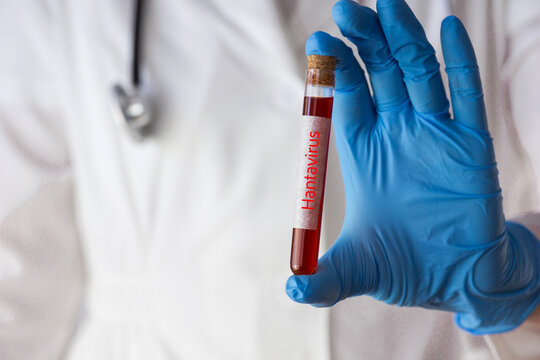scientist holding test tube with hantavirus blood sample closeup medical worker in protective gloves and mask doing laboratory research concept of virus diagnostic and quarantine