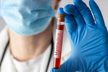 Fototapeta na wymiar scientist holding test tube with hantavirus blood sample closeup medical worker in protective gloves and mask doing laboratory research concept of virus diagnostic and quarantine