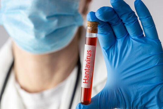 scientist holding test tube with hantavirus blood sample closeup medical worker in protective gloves and mask doing laboratory research concept of virus diagnostic and quarantine