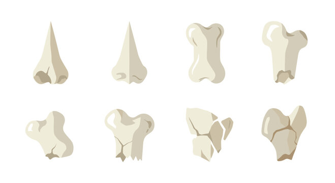 Collection of realistic cartoon style broken bones and nose fragments isolated on white background