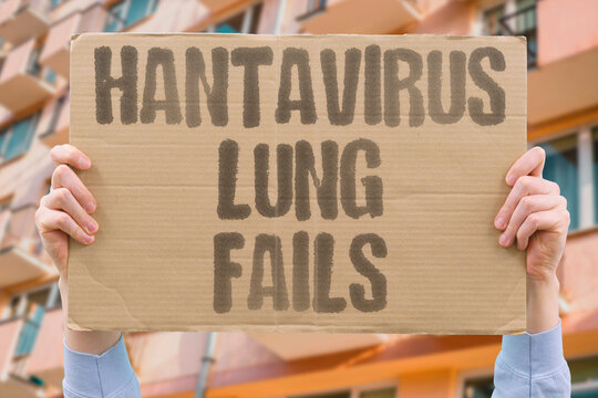 "Hantavirus Lung Fails" Severe hantavirus infection causes acute respiratory distress and death. SEVERE. INFECTION. ACUTE. RESPIRATORY. DISTRESS.