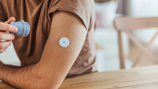 Young Man Applying Continuous Glucose Monitor Sensor To Upper Arm Managing Diabetes At Home