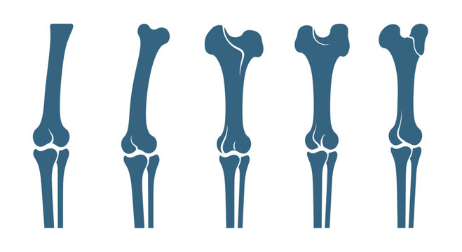 Stages of Bone Growth and Development: From Immature to Mature Long Bone