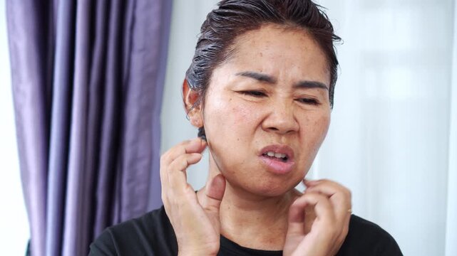 Asian woman scratching her face and neck due to itchiness and scalp irritation from a hair dye allergy, with visible redness and skin rash. Concept of chemical sensitivity and allergic 