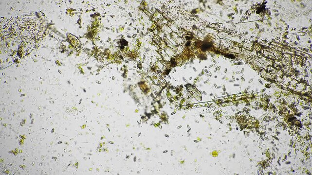 Filamentous algae mat stretched across view under microscope, intertwined filaments and biofilm textures documented by water quality inspector for monitoring and sustainability reporting.