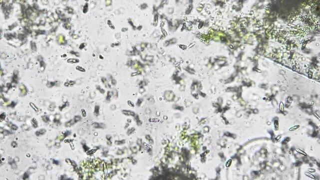 Microscopic examination reveals broad spectrum of microbial shapes and activities. Researchers document wideranging microbial diversity and motility for taxonomy and microbiome studies