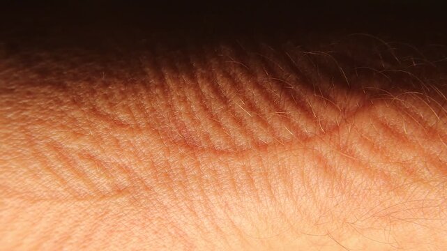 Temporary sleep marks and pressure lines on human hand skin after resting on fabric during sleep. for dermatology, skincare, dehydration, aging, circulation, pressure effects and medical concepts.
