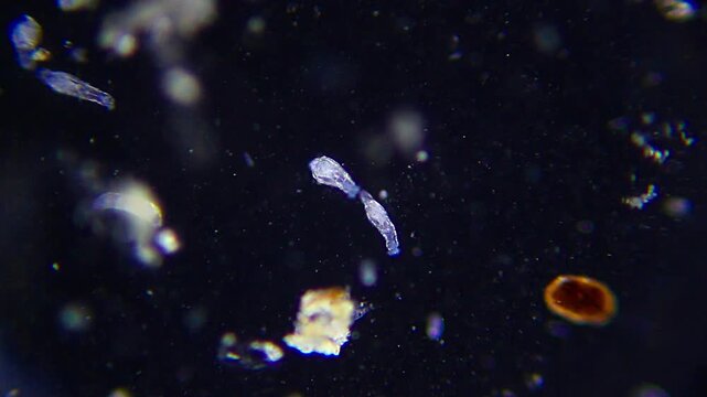 Rotifers with large annelid worm in background under 40x magnification darkfield microscopy. 4K scientific microscopy footage.