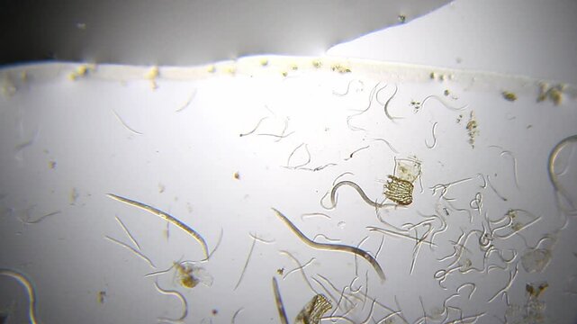 Nematodes aggregation actively moving in water droplet under 40x magnification brightfield microscopy. 4K scientific microscopy footage.